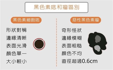 凸痣長毛|為什麼臉上的痣越來越多？皮膚科醫師解析長痣原因、。